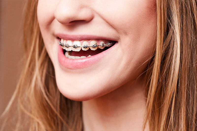 Orthodontics in Gurnee